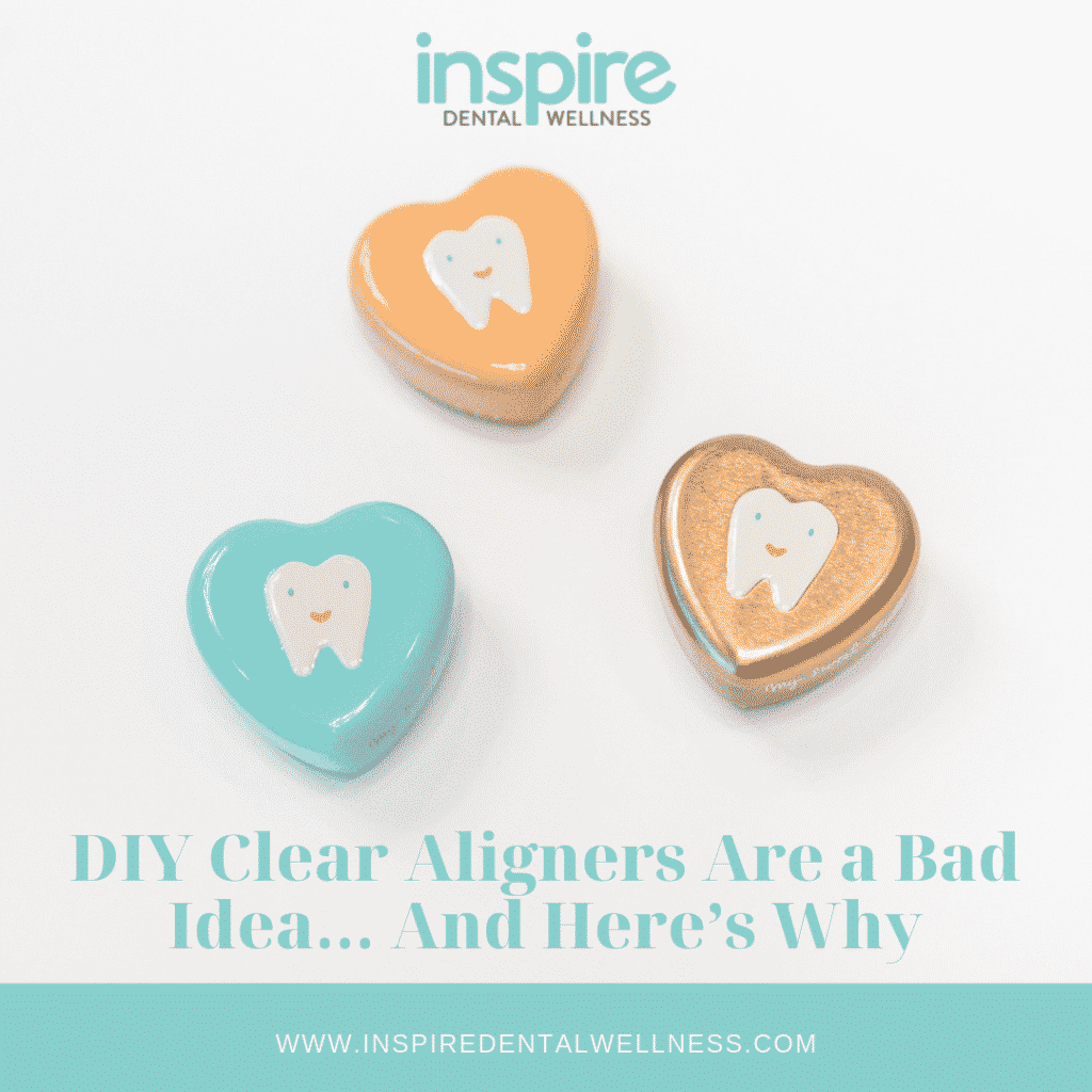 DIY Clear Aligners Blog Graphic