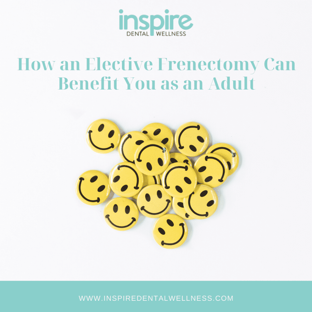 Elective Frenectomy Blog Image