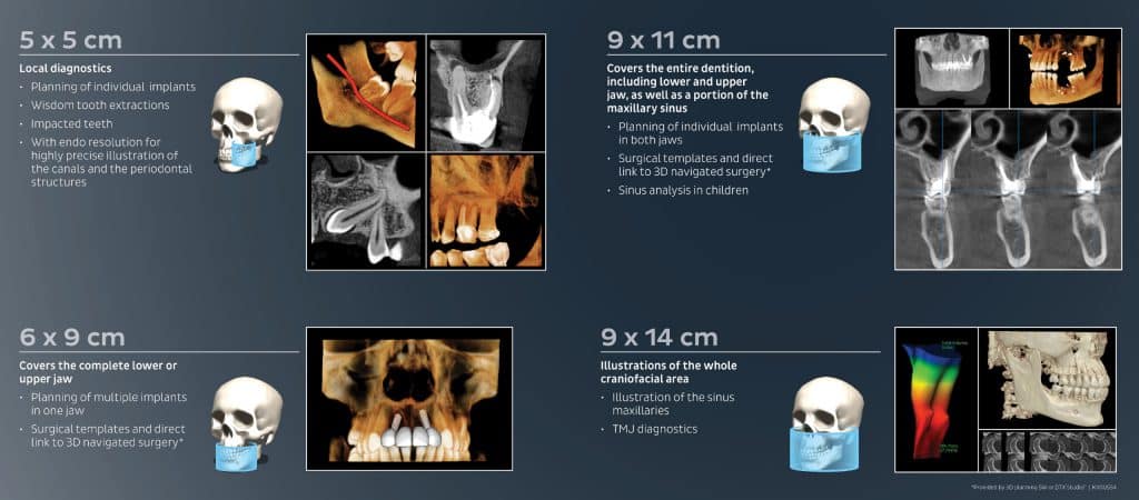 Cone Beam CT