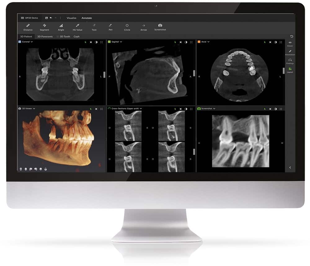 Cone Beam CT Imaging