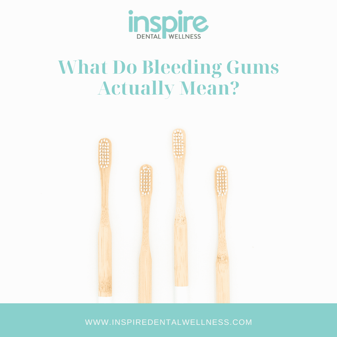 Bleeding Gums Blog Graphic