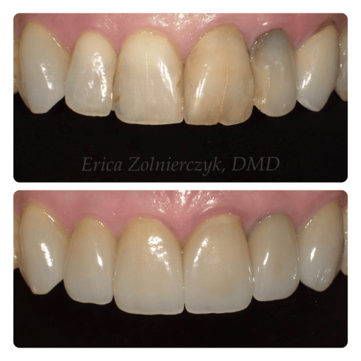 60462 Dentist Dentist Orland Park IL