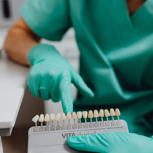 orland-park-dental-bonding orland park dental bonding